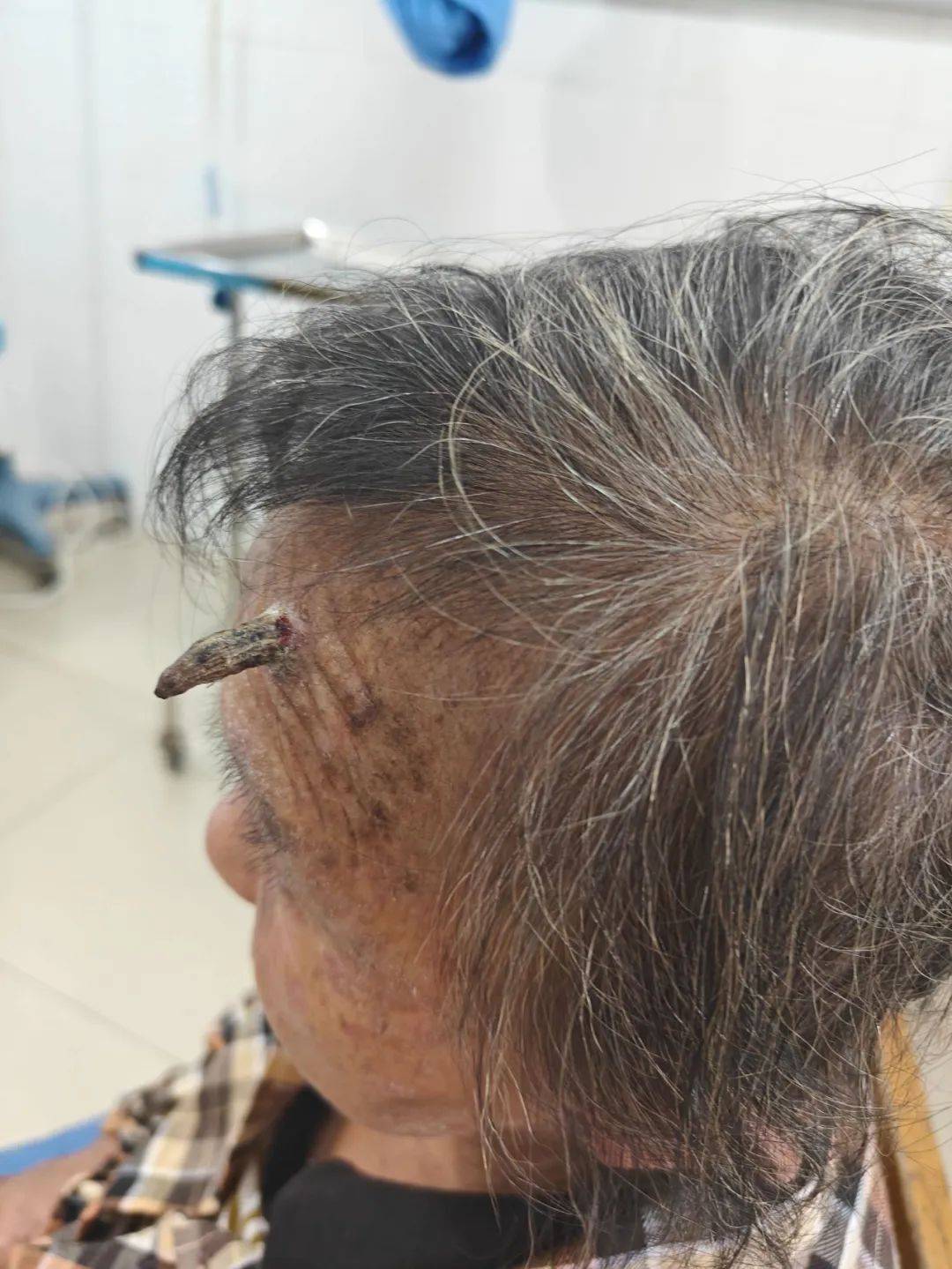 太狠了！98岁阿婆拿起剪刀，对准自已一刀下去…后果很严重！